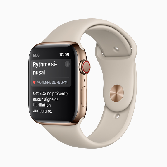 L’Apple Watch Series 4 affichant un rythme sinusal.