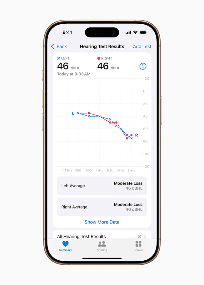 Résultats audiométriques affichés sur iPhone 16 Pro.